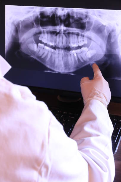 Best Emergency Dentist for Knocked-Out Tooth in Crozet, VA